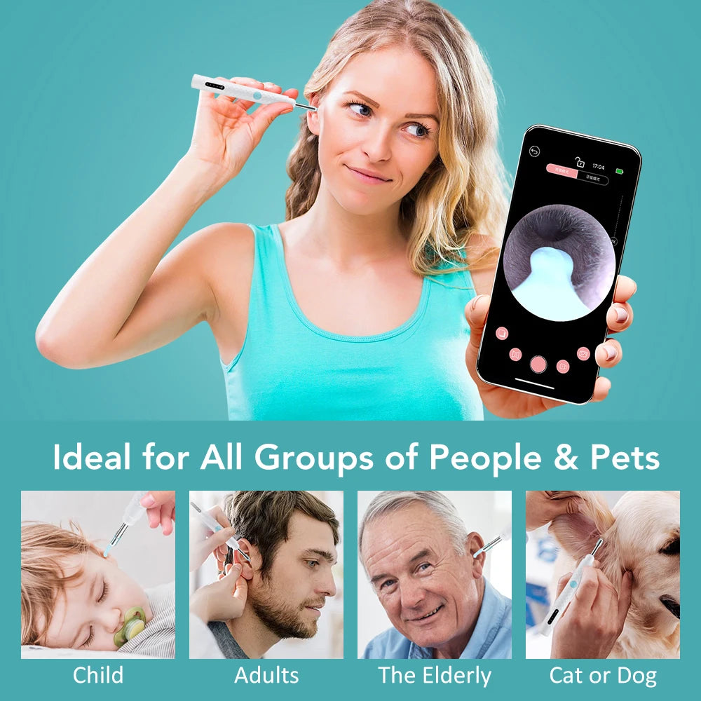 WaxWand - WiFi Elimination Otoscope