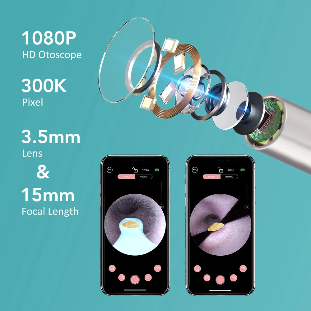 WaxWand - WiFi Elimination Otoscope
